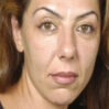 basak ozel