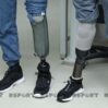 protez 12