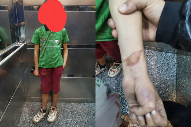 Xırdalanda ana və ata uşağa xəsarət yetirib küçəyə atdılar - FOTOLAR