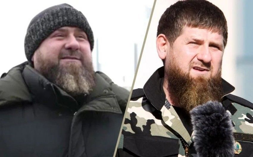 Kadırovun səhhətində ciddi problem yarandı