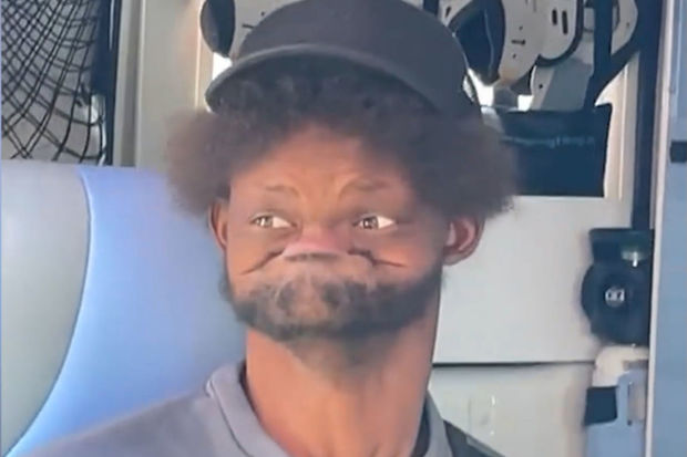 Koronavirus testi verən şəxsin görüntüləri rekord qırdı - VİDEO 1 Koronavirus testi verən şəxsin görüntüləri rekord qırdı - VİDEO