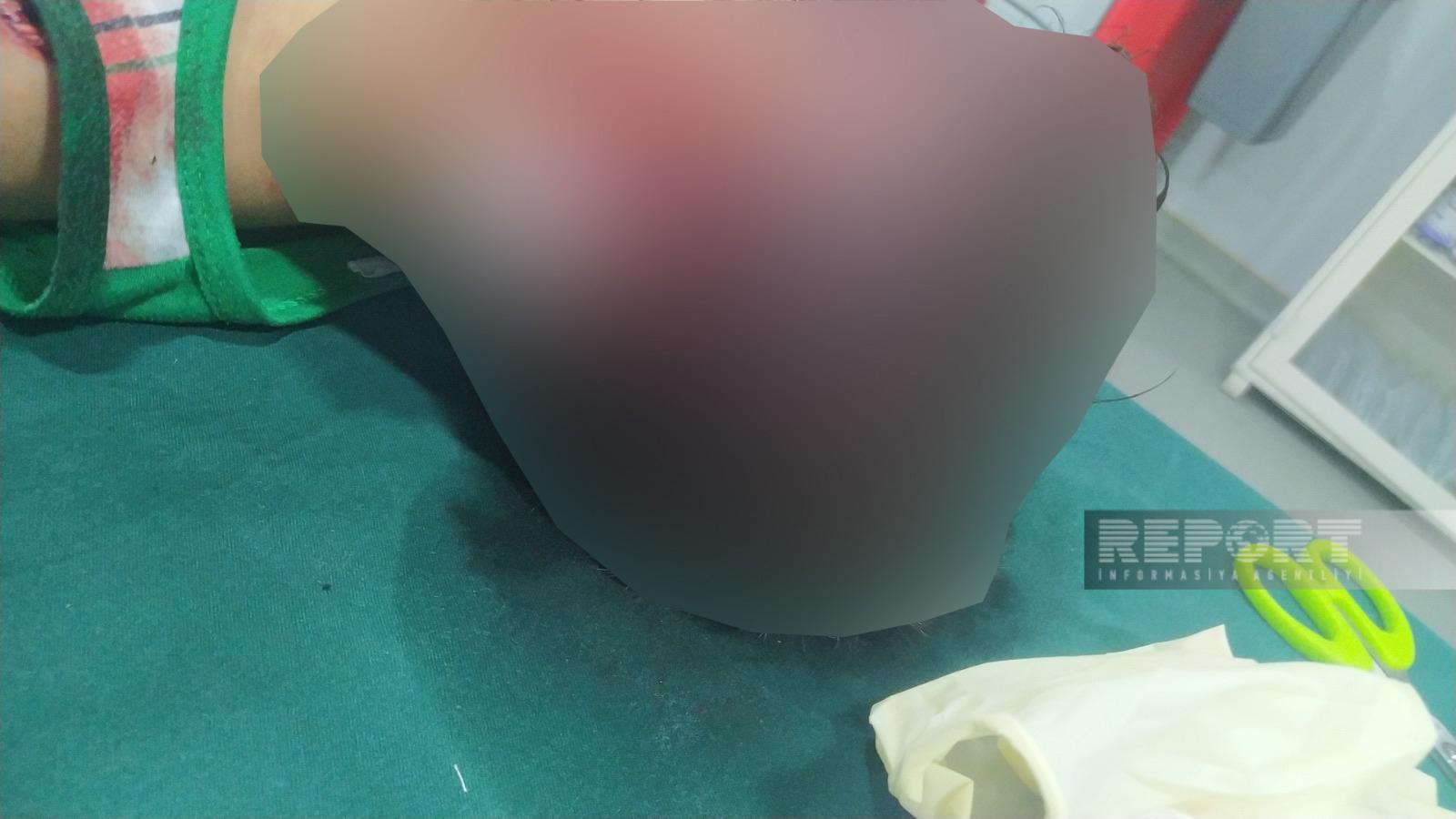 Masazırda azyaşlı uşaqlar itlərin hucumuna məruz qaldı - Vəziyyətləri ağırdır