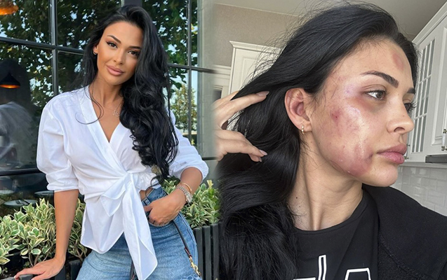 Amansızlıqla döyülən modelin sevgilisi haqda yeni məlumat üzə çıxdı