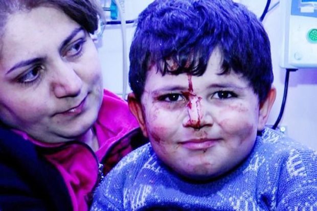 Gəncə terrorunun şahidləri: Balaca Bəxtiyar 3 il sonra - VİDEO 1 bextiyar gence1