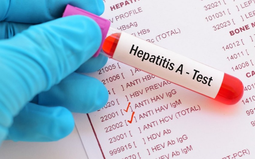 hepatit a