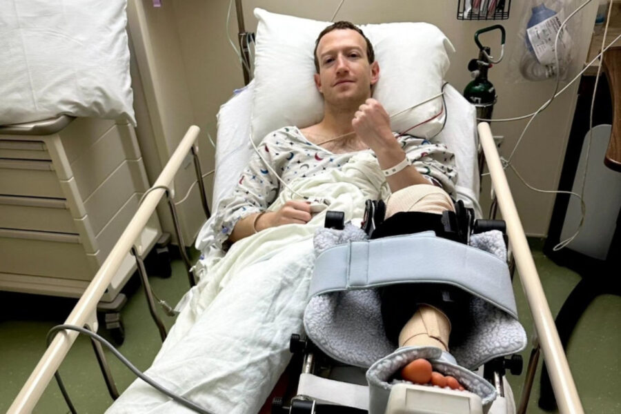 Zukerberq əməliyyat olundu