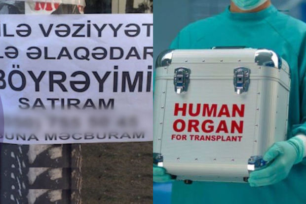 Orqan satışı elanlarını yayanlar kimlərdir? - VİDEO 1 FotoJet 1