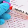 hepatit a