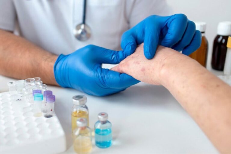 Qızılca və suçiçəyi ilə bağlı epidemioloji vəziyyət açıqlandı