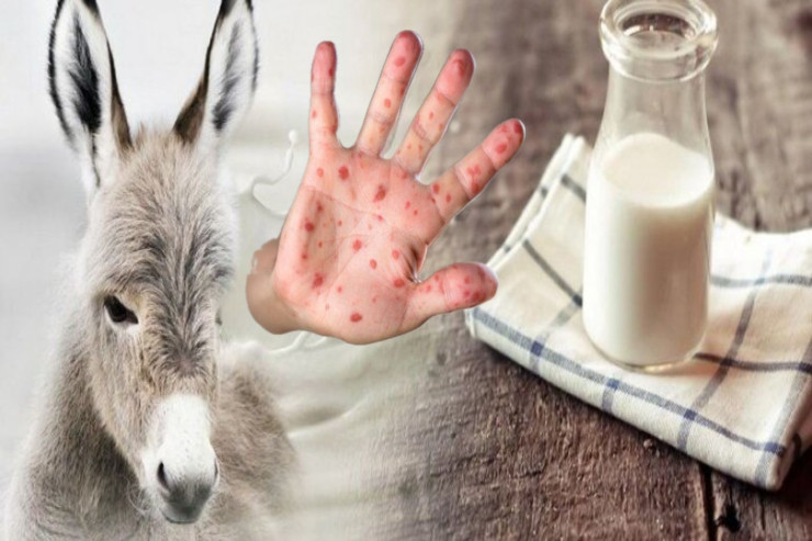 Tüğyan edən qızılcanı bıçaq kimi “kəsən” dərman