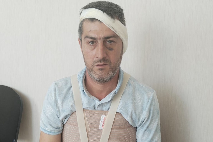 Bərdə sakininin qulağını kəsiblər? - Polis araşdırır