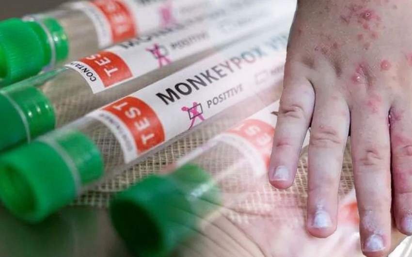 Virus təhlükəsi: 3,6 milyon doza vaksin ayırıldı