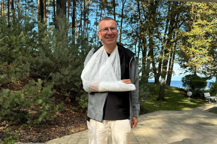 Latviya Prezidenti velosipeddən yıxıldı, qolunu sındırdı - FOTO