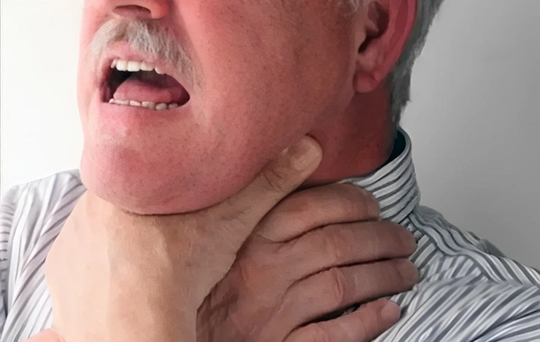 Bakıda boğazında yemək qalan kişi öldü