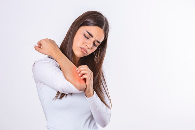 young woman scratching her itchy arm skin problems allergy healthcare medical concept 1212 3081