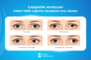 cepgozluk