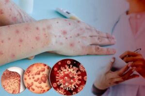 Meymunçiçəyinə görə sərnişinlərə... - DGK