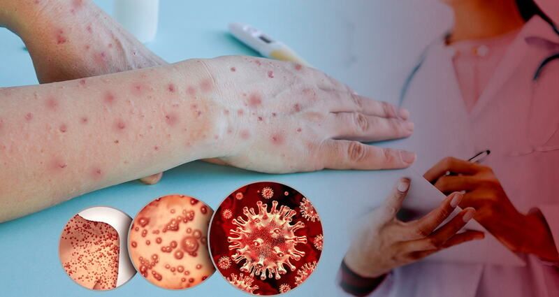 Meymunçiçəyinə görə sərnişinlərə... - DGK