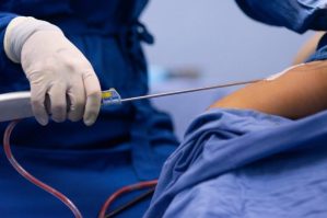 Sumqayıtda 34 yaşlı qadın liposaksiyadan sonra ölüb