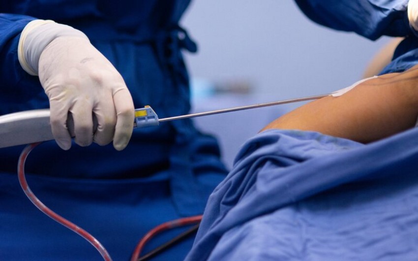 Sumqayıtda 34 yaşlı qadın liposaksiyadan sonra ölüb 1 243b0438 85a9 3bb2 b838 d5a1940c2160 850