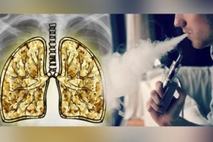 Həyəcan təbili: Elektron siqaretdən istifadə bu xəstəliyə səbəb olur 22 Həyəcan təbili: Elektron siqaretdən istifadə bu xəstəliyə səbəb olur