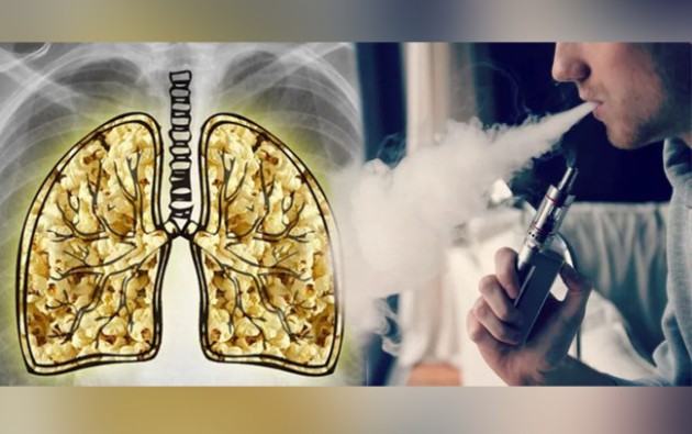 Həyəcan təbili: Elektron siqaretdən istifadə bu xəstəliyə səbəb olur