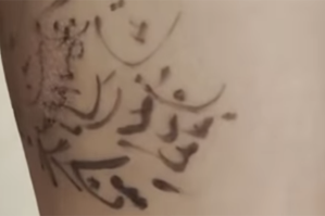 İlahiyyatçı mollanın "möcüzəvi müalicə"sindən danışdı - VİDEO