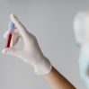 back view doctor holding blood sample