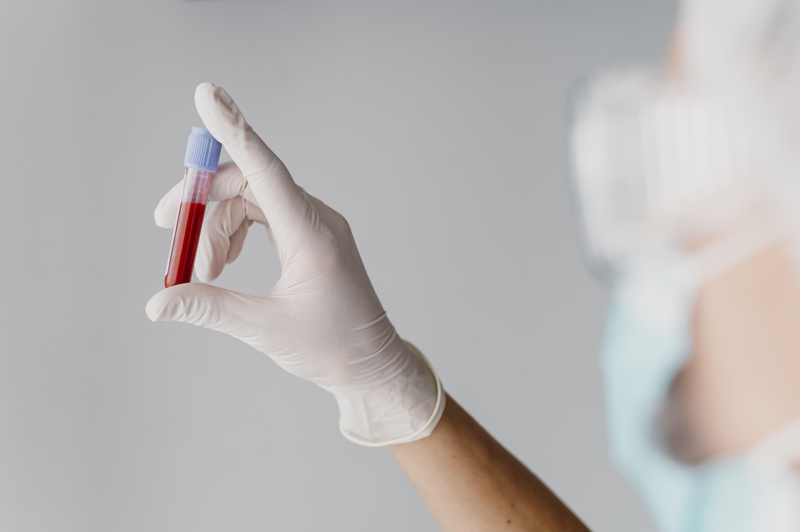 back view doctor holding blood sample scaled