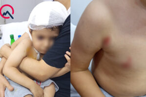 Masazırda it 2 yaşlı uşağa hücum etdi - FOTOLAR