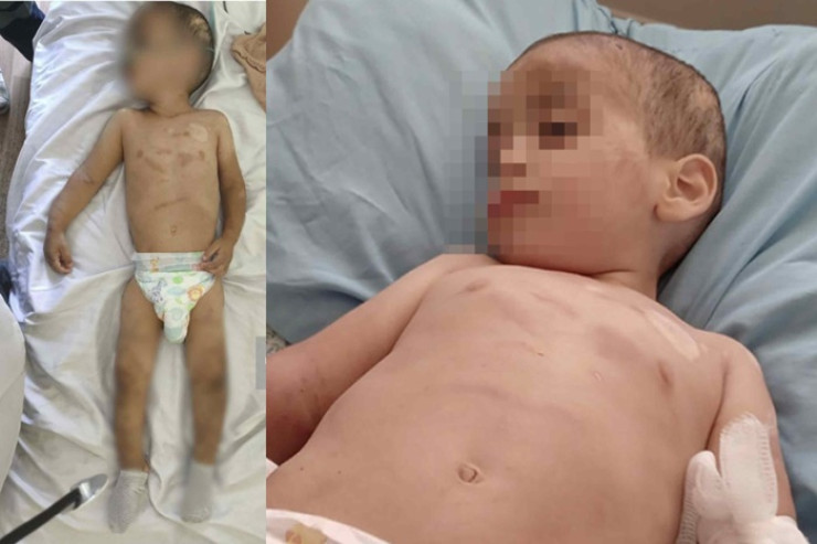 Ağdamda atası döyən uşaqla bağlı daha bir dəhşətli fakt: xalası da...