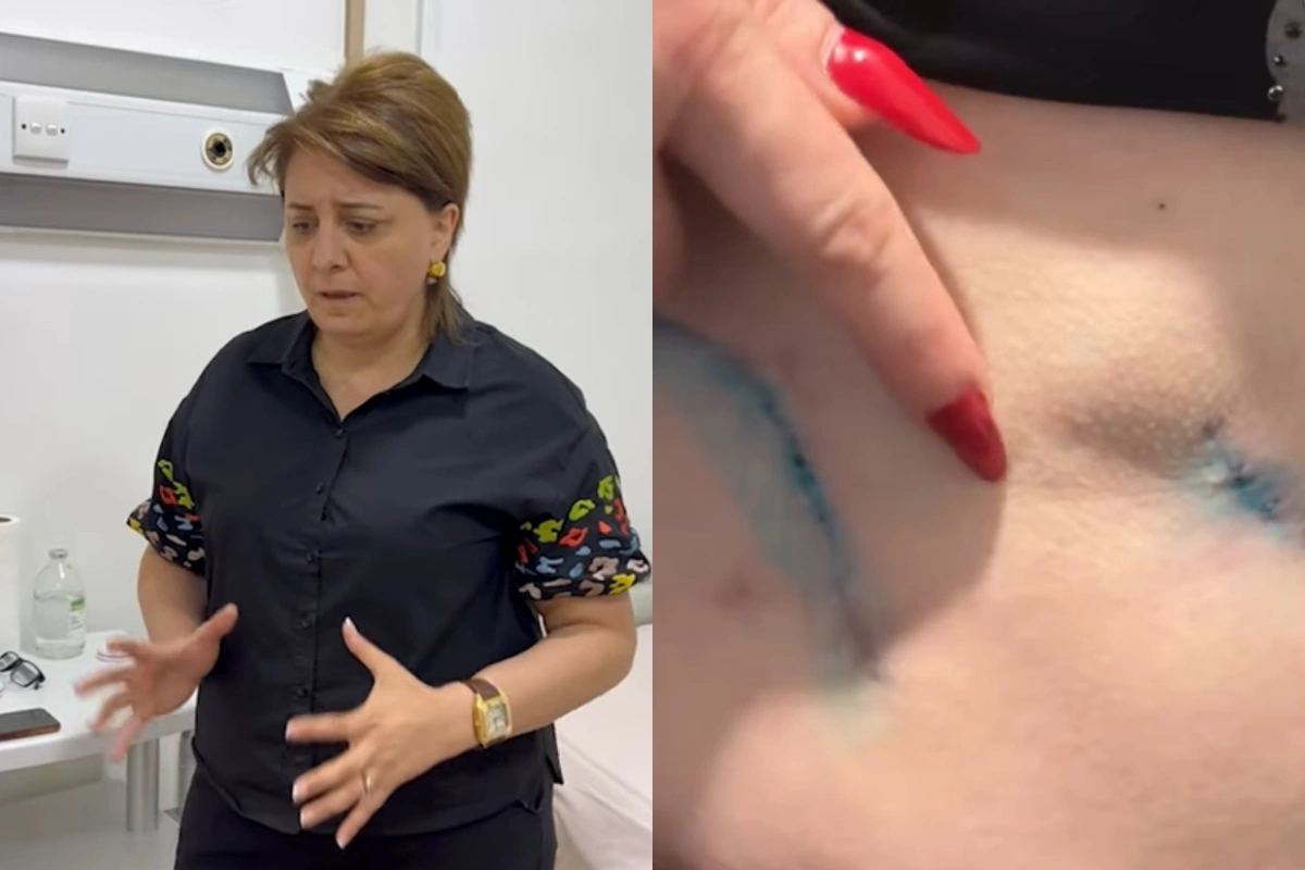 Pasiyentin ölümündə adı keçən həkim yenidən cərrahlıq edir?