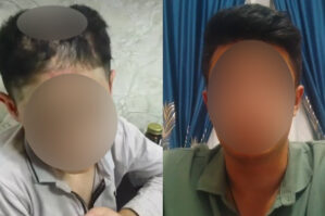 14 yaşlı yeniyetmənin qardaşı: “O işgəncələri atam edib...” - VİDEO