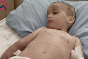 Döyülən azyaşlının vəziyyəti ağır olaraq qalır