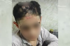 Həmin yeniyetmə səhiyyə müəssisəsinə yerləşdirildi