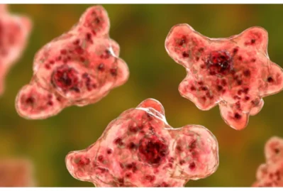 Bu ölkədə nadir xəstəlik tapıldı: 19 nəfər həyatını itirdi