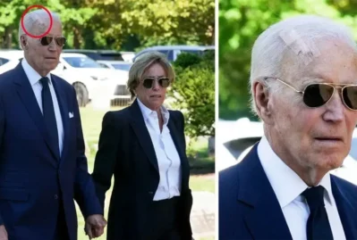 Baydenin başına nə olub? - FOTO