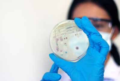 Xərçəngə qarşı yeni dərman yaradılır - Mühüm araşdırma