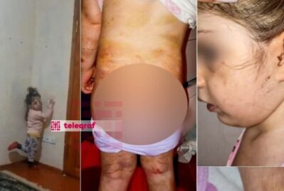 4 yaşlı qıza verilən işgəncələr: bədəni yandırılıb, kəmərlə döyülüb... - FOTO