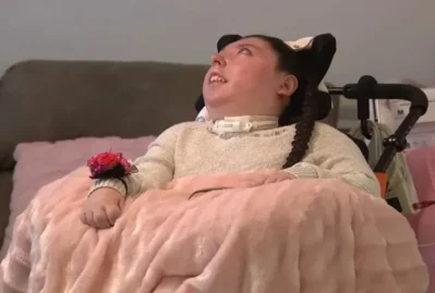 Həkimlər “beş yaşına qədər yaşamaz” demişdilər - 20 yaşı oldu