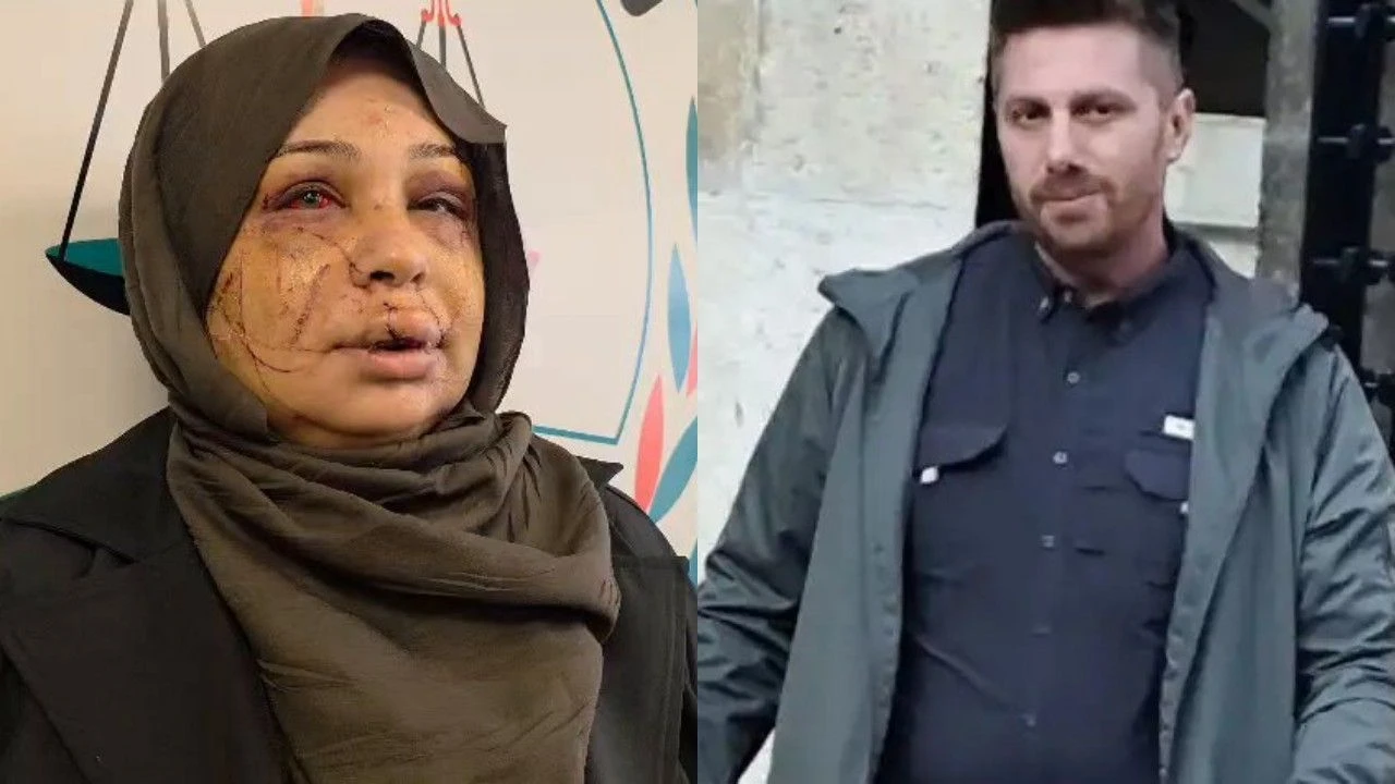 Ərdoğanın mühafizə xidmətinin əməkdaşı həbs olundu - Səbəb