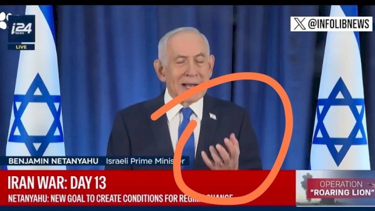 Netanyahunun barmaqları diqqət çəkdi - VİDEO 1 nat
