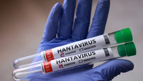 hantavirus 1