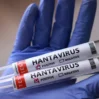 hantavirus 1