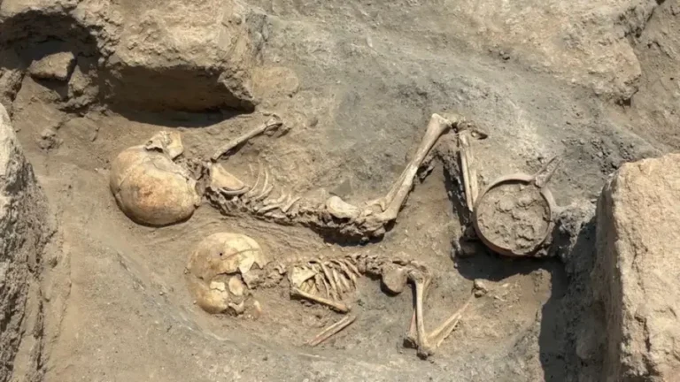 Alimlərdən heyrətləndirən kəşf: uşağın kəlləsində görün nə tapıldı