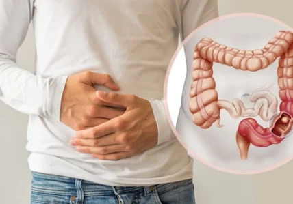 Həkimdən bağırsaq xərçəngi ilə bağlı xəbərdarlıq – Araşdırma