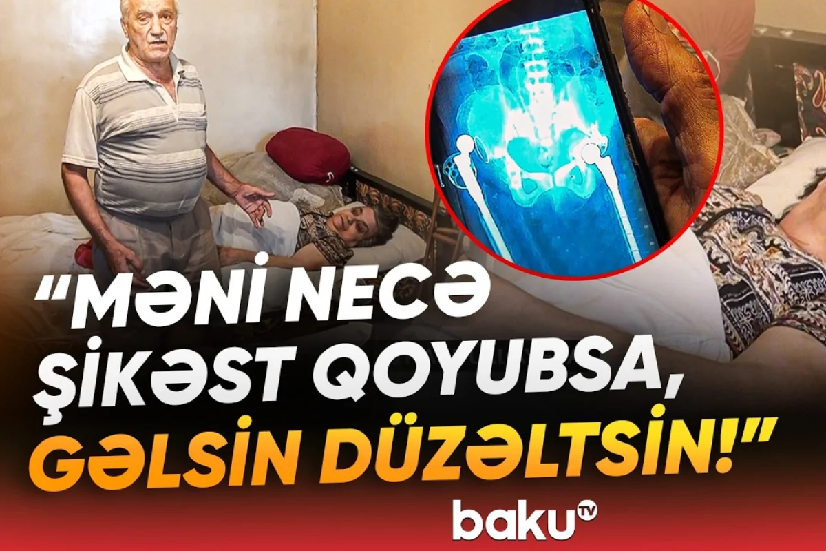 Qadının sol ayağının yerinə sağ ayağı əməliyyat edilib? - VİDEO 1 sol sag
